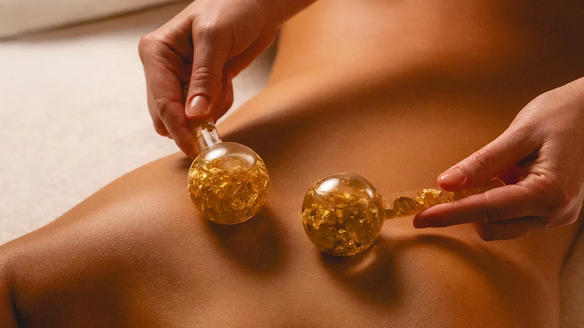 Cupping therapy in progress: two glass cups placed on a person’s bare back while a practitioner handles them.