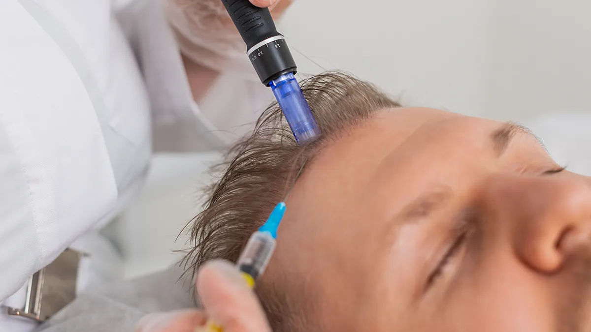 Clinician performing a scalp treatment with a blue-tipped handheld device on the patient's head, a syringe visible nearby.